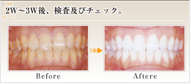 5. 2W～3W後、検査及びチェック。