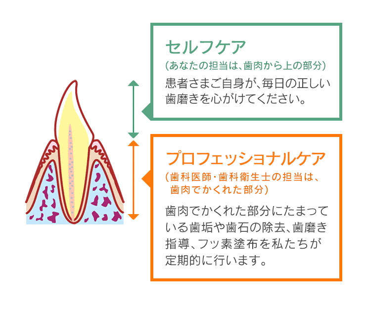 セルフケア（あなたの担当は、歯肉から上の部分）：／プロフェッショナルケア（歯科医師・歯科衛生士の担当は、歯肉でかくれた部分）